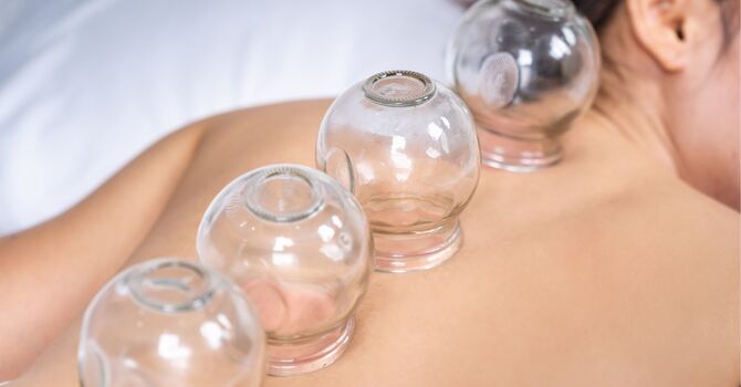 Understanding Acupuncture: Debunking Common Myths image