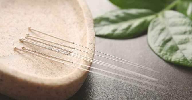 Acupuncture and Traditional Chinese Medicine