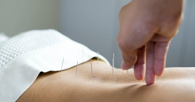 Can Acupuncture Help With Women’s Health? A Holistic Approach for Every Stage of Life